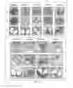 Fig. 12 - Expression enhancing intron sequences