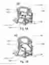 Fig. 02 - Devices and methods for body elevation