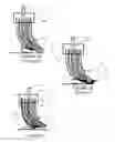 Fig. 02 - Brush and broom bristle
