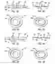 Fig. 11 - Scrubbing razor