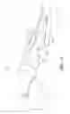 Fig. 05 - ORTHOTIC DEVICES