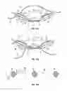 Fig. 05 - Directional guide for fishing lures