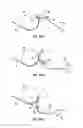 Fig. 06 - Directional guide for fishing lures