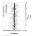 Fig. 06 - Apparatus and method for noninvasive particle detection using doppler spectroscopy