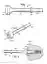 Fig. 02 - Seized fastener removal tool and set