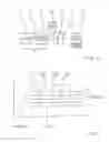 Fig. 02 - Method of resolving a tooth-on-tooth situation