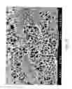 Fig. 09 - Polysaccharide pseudo-sponge