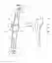 Fig. 02 - Screen supporting apparatus