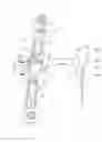 Fig. 05 - Screen supporting apparatus