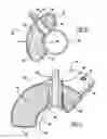 Fig. 05 - Compact coulomb damper