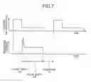 Fig. 08 - METHOD OF MANUFACTURING ELECTRODE FOR ELECTRICAL-DISCHARGE SURFACE TREATMENT, AND ELECTRODE FOR ELECTRICAL-DISCHARGE SURFACE TREATMENT