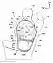 Fig. 01 - Side airbag device for vehicle