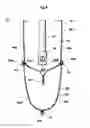 Fig. 05 - Side airbag device for vehicle