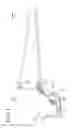 Fig. 06 - Deflector apparatus for vehicle