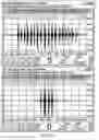Fig. 06 - Adaptive filter in a sensor array system