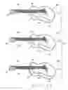 Fig. 08 - Audio device, and methods for designing and making the audio devices