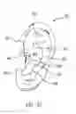 Fig. 28 - Ergonomic earpiece and attachments