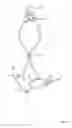 Fig. 03 - Security and protection device for an ear-mounted audio amplifier or telecommunication instrument