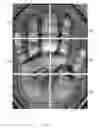 Fig. 22 - Contactless multispectral biometric capture