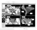 Fig. 01 - Method and apparatus for efficient three-dimensional contouring of medical images