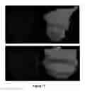 Fig. 19 - Method and apparatus for efficient three-dimensional contouring of medical images