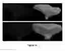 Fig. 20 - Method and apparatus for efficient three-dimensional contouring of medical images