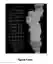 Fig. 22 - Method and apparatus for efficient three-dimensional contouring of medical images