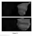 Fig. 19 - Method and apparatus for efficient three-dimensional contouring of medical images
