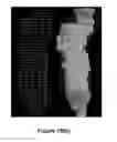 Fig. 22 - Method and apparatus for efficient three-dimensional contouring of medical images