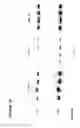 Fig. 18 - PROCESS FOR THE PREPARATION OF A COMPOSITION OF GENETICALLY MODIFIED HEMATOPOIETIC PROGENITOR CELLS