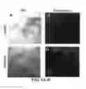 Fig. 07 - Compositions and methods for diagnosing, treating, and preventing prostate conditions