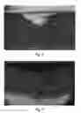 Fig. 08 - Method of making implantable devices with reduced needle puncture site leakage