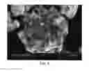 Fig. 04 - Graphene-enhanced cathode materials for lithium batteries
