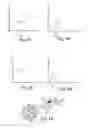 Fig. 04 - DENTAL INSTRUMENT AND METHOD OF USE