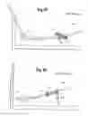 Fig. 10 - Stride adjustment mechanism