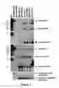 Fig. 02 - Method for diagnosing  acute lymphomic leukemia (ALL) using miR-125b