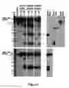 Fig. 04 - Method for diagnosing  acute lymphomic leukemia (ALL) using miR-125b