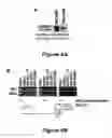 Fig. 05 - Method for diagnosing  acute lymphomic leukemia (ALL) using miR-125b