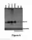 Fig. 09 - Method for diagnosing  acute lymphomic leukemia (ALL) using miR-125b
