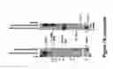Fig. 11 - Method for diagnosing  acute lymphomic leukemia (ALL) using miR-125b