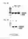 Fig. 04 - Method for efficient exon (44) skipping in duchenne muscular dystrophy and associated means