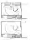 Fig. 08 - Navigation system for cardiac therapies