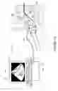 Fig. 16 - Navigation system for cardiac therapies