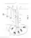 Fig. 02 - Self-Powered Ablation Catheter for Renal Denervation