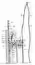 Fig. 01 - Adaptive floating flange for ostomy appliance