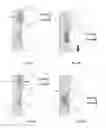 Fig. 17 - Apparatus and methods for ablation efficacy
