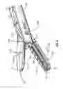 Fig. 05 - Asymmetrical electrodes for bipolar vessel sealing