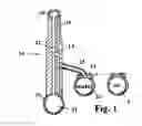 Fig. 02 - Delivery system and urethra stent for enlarged prostates and method