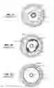 Fig. 02 - Device and method for compartmental vessel treatment