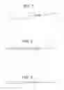 Fig. 02 - VENOUS DISSECTOR DEVICE